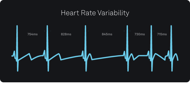 normal heart rate line