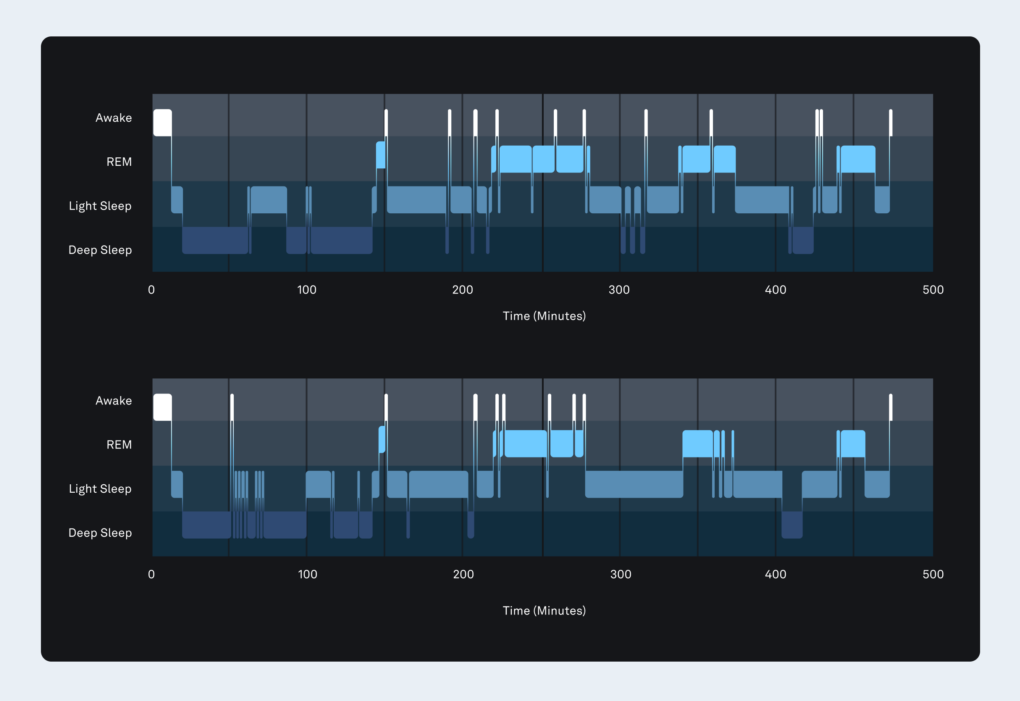 Technology in the Oura Ring - The Pulse Blog