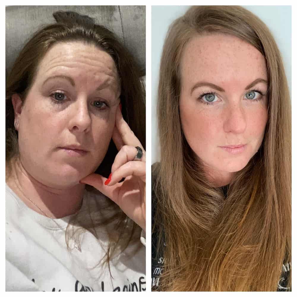 Before and After Sobriety Photo: Gemma’s Journey to Being Alcohol-Free With Oura