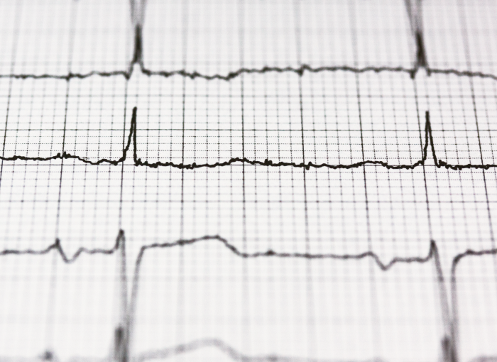 Why Is My Heart Rate High in the Morning? - The Pulse Blog