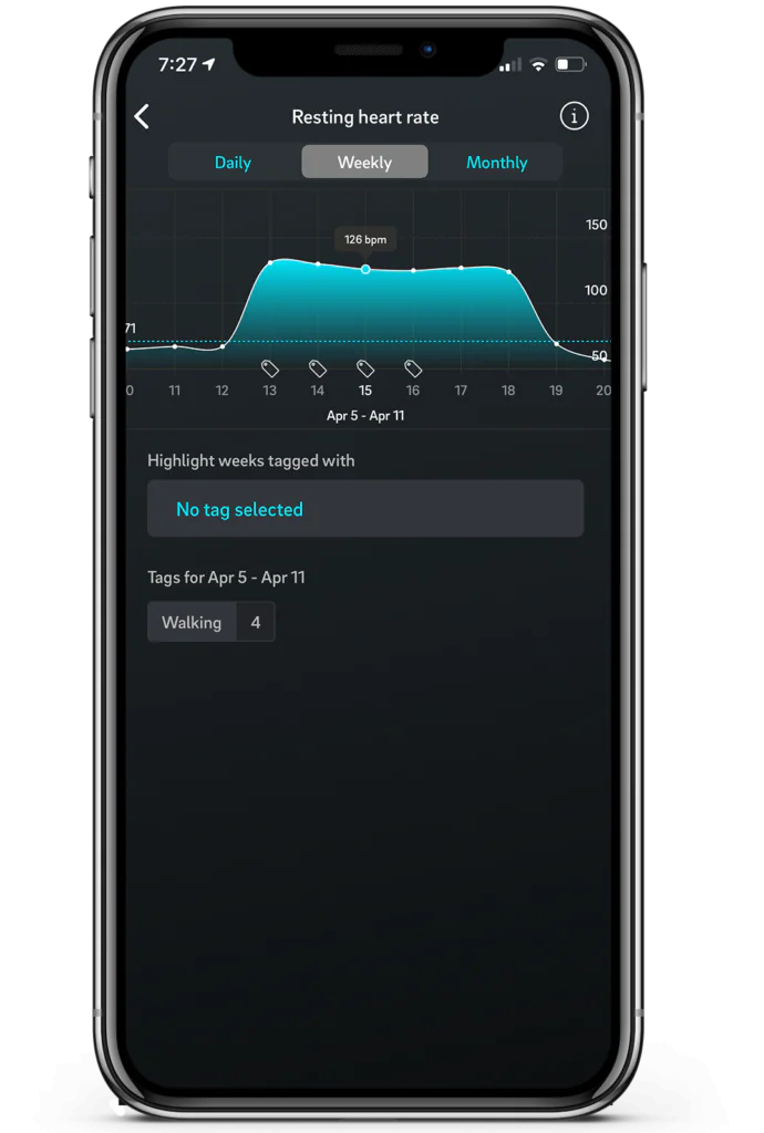 Oura user heart problem heart rate